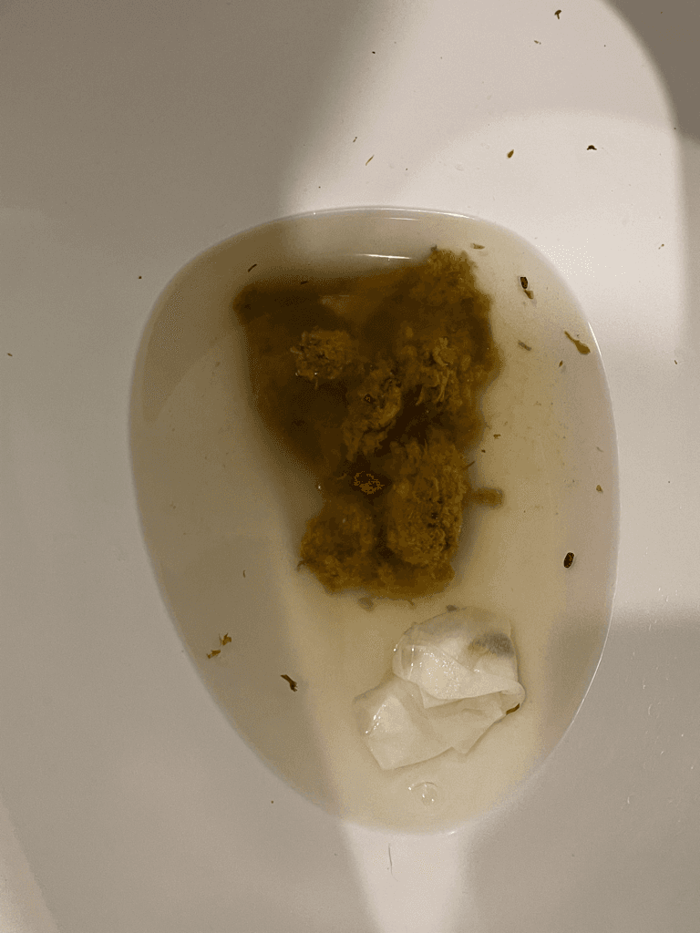 3번 째 사진