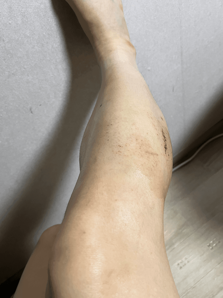 2번 째 사진