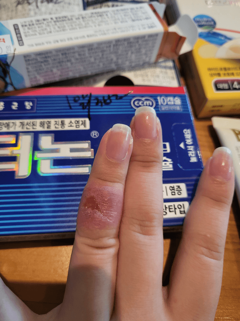 2번 째 사진