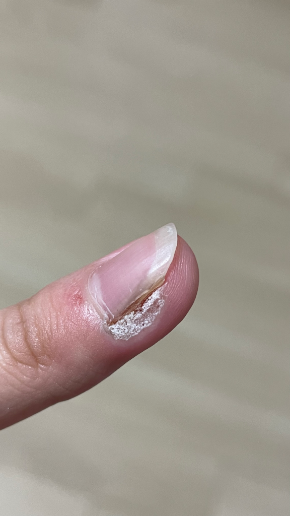 3번 째 사진