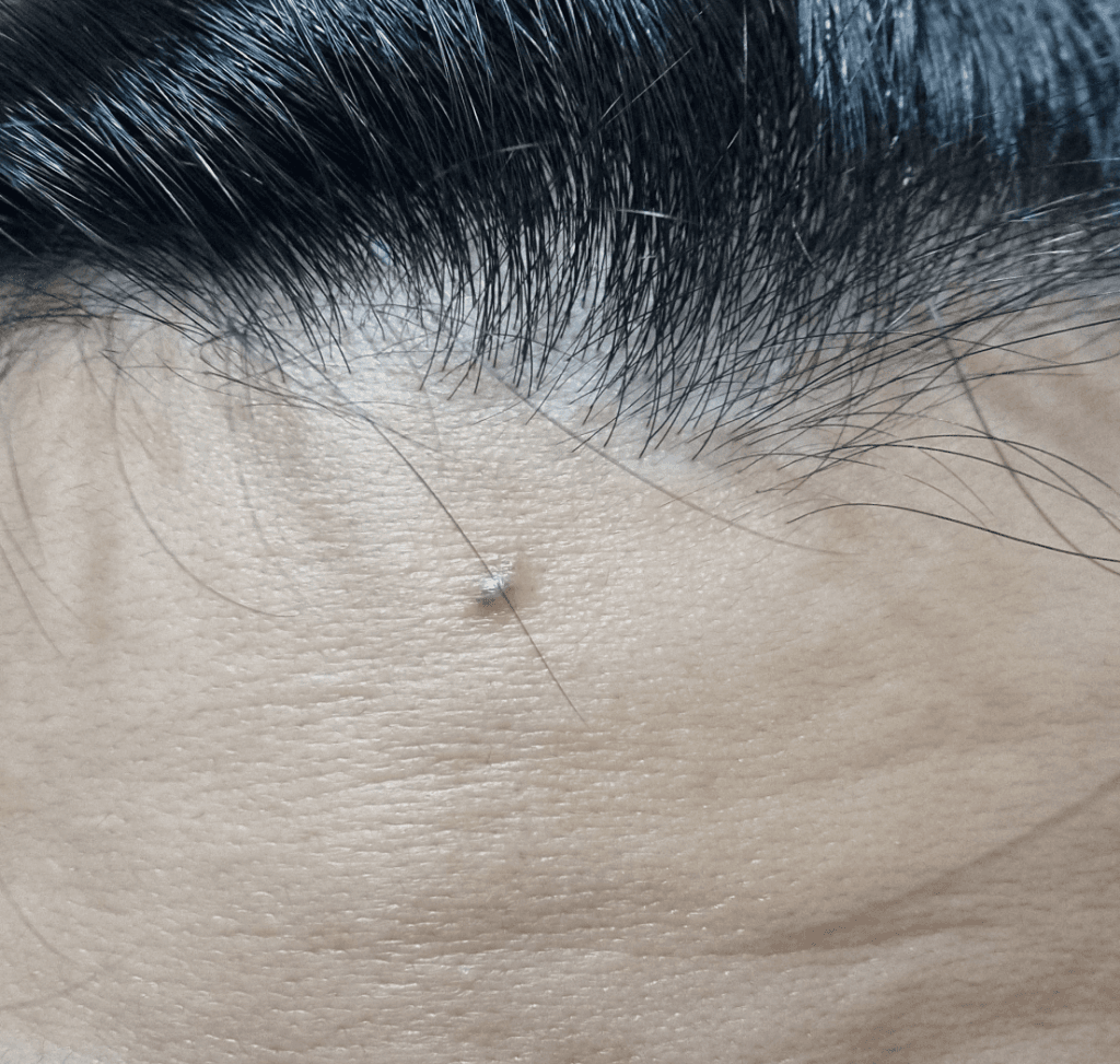 1번 째 사진