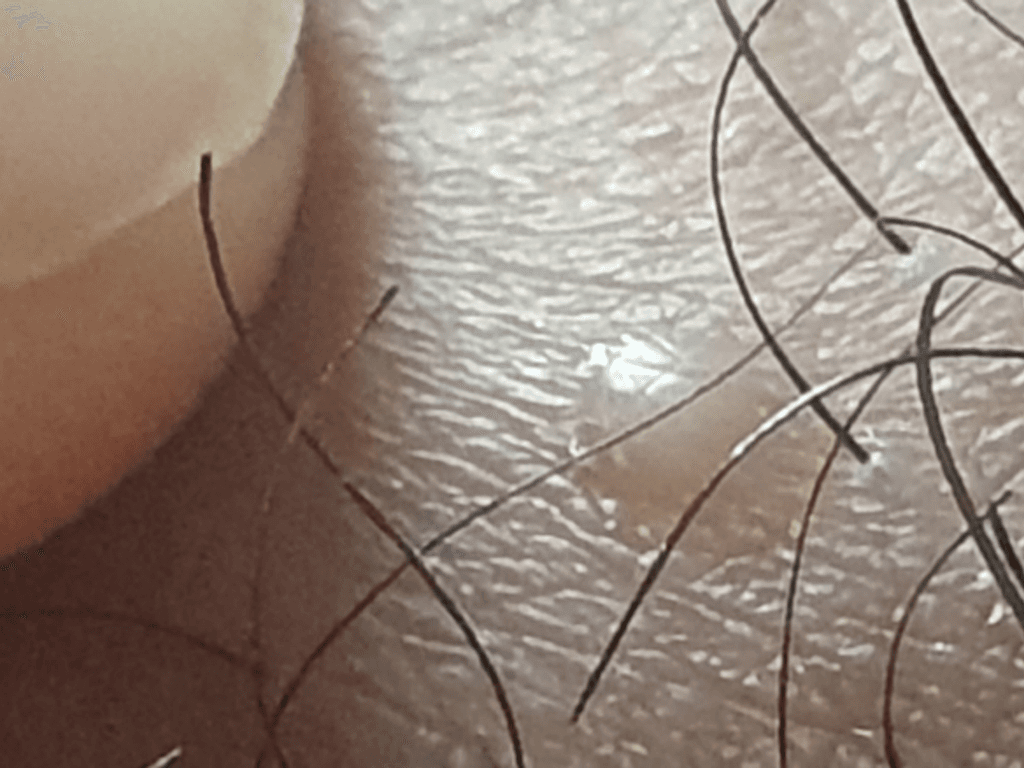 2번 째 사진