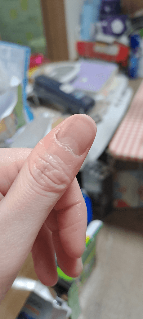 2번 째 사진