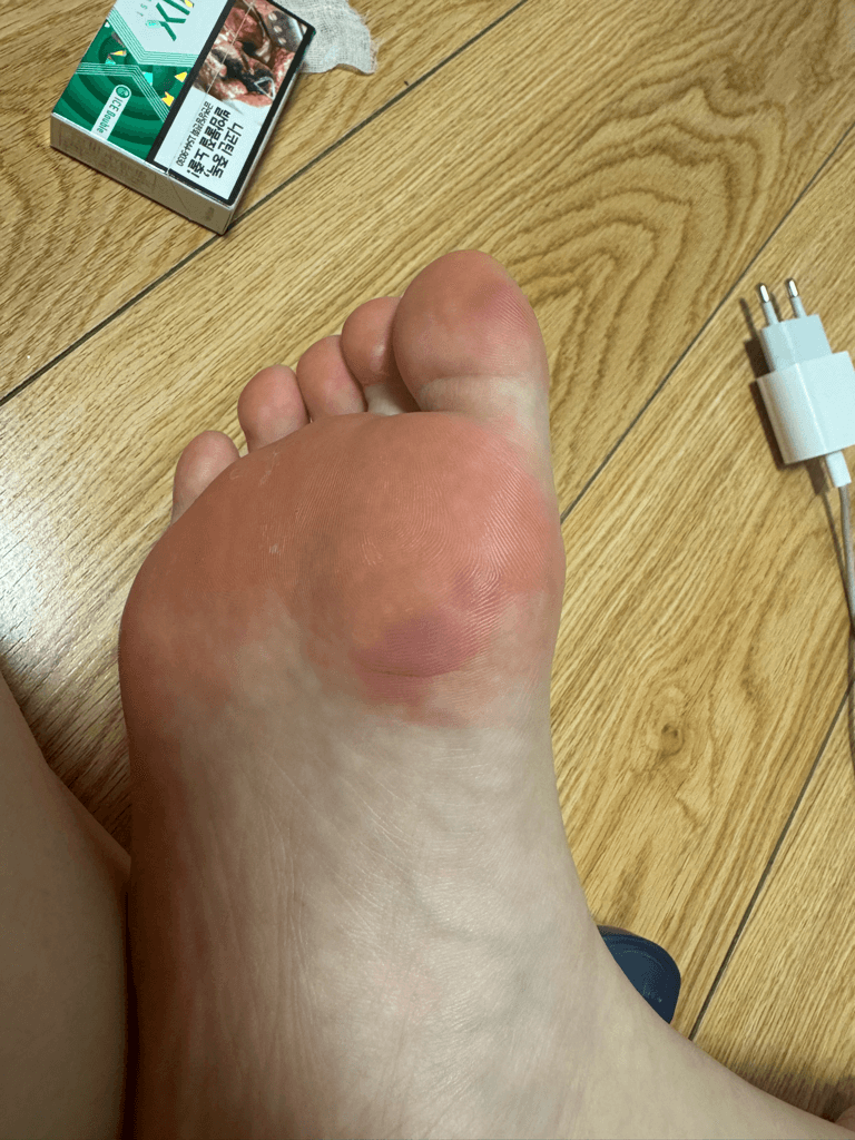 1번 째 사진