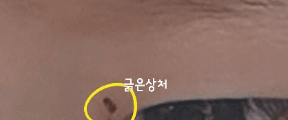 1번 째 사진