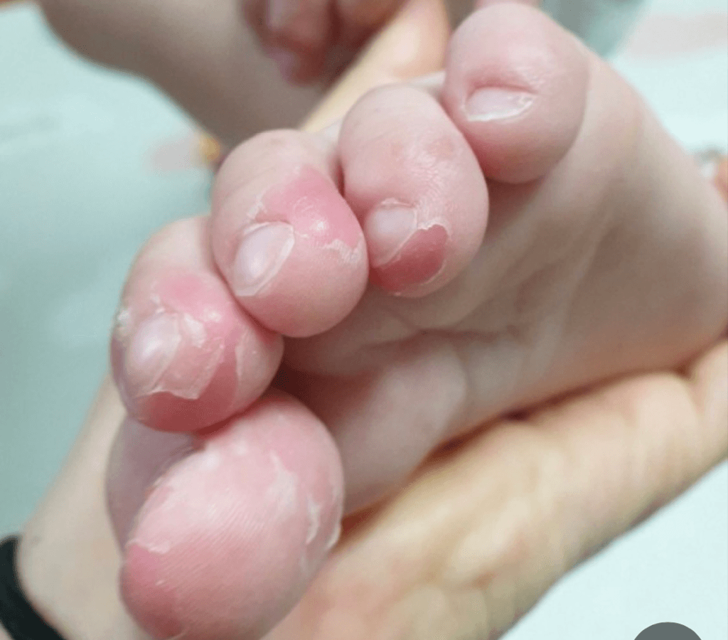 2번 째 사진