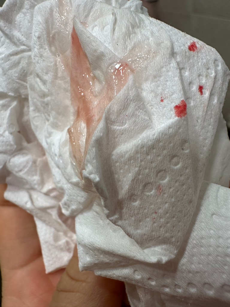 2번 째 사진