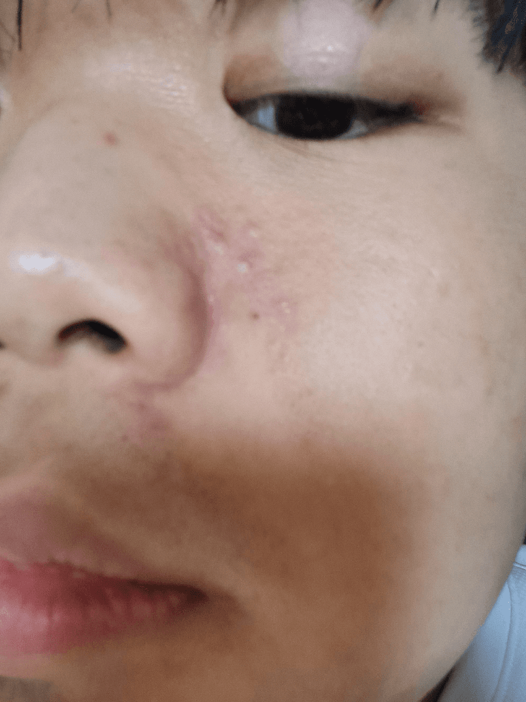 2번 째 사진