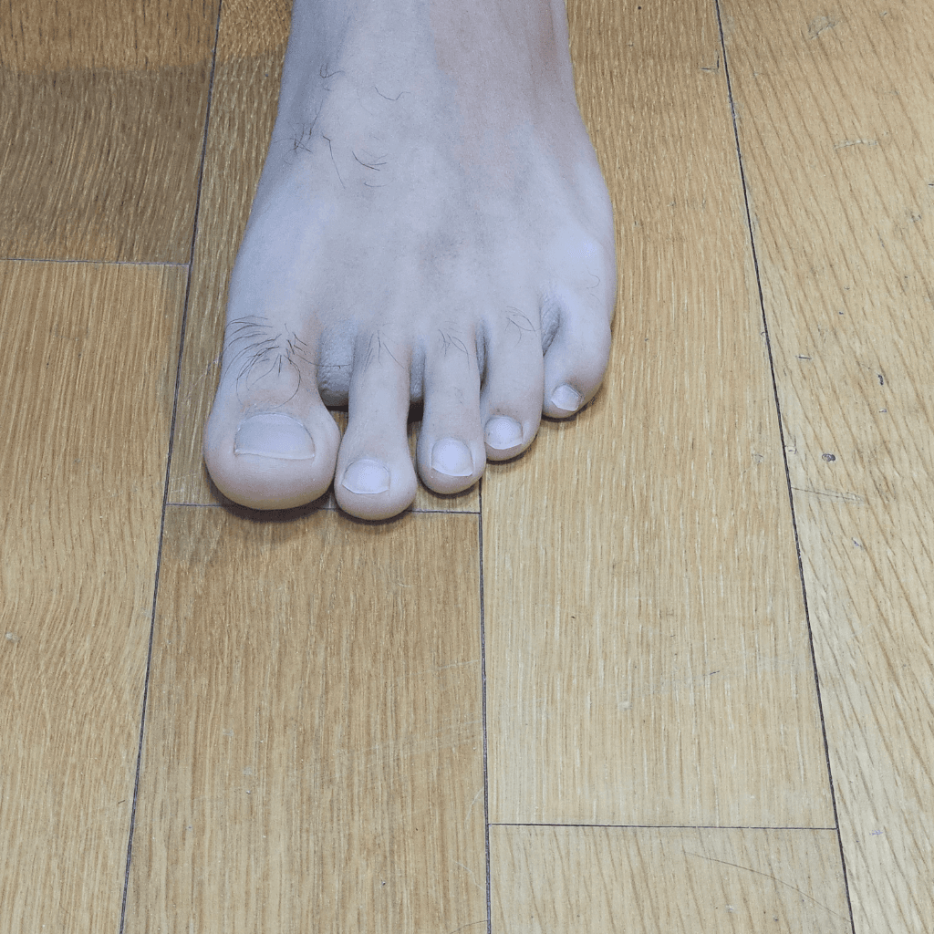 2번 째 사진