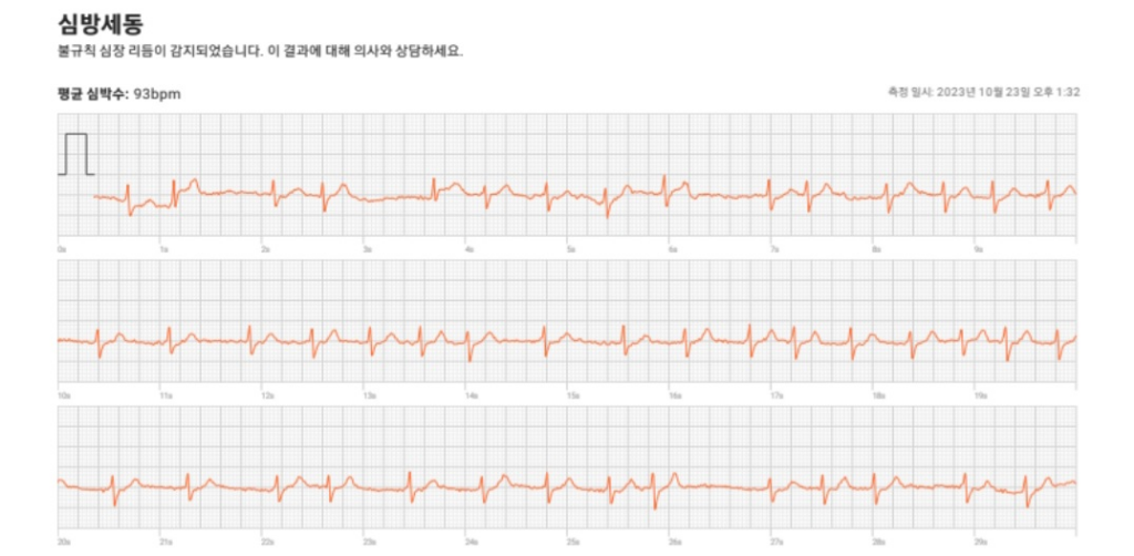 2번 째 사진