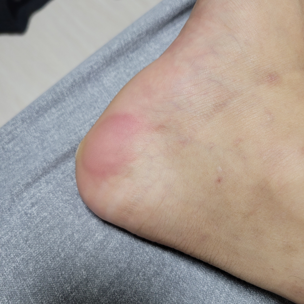 2번 째 사진