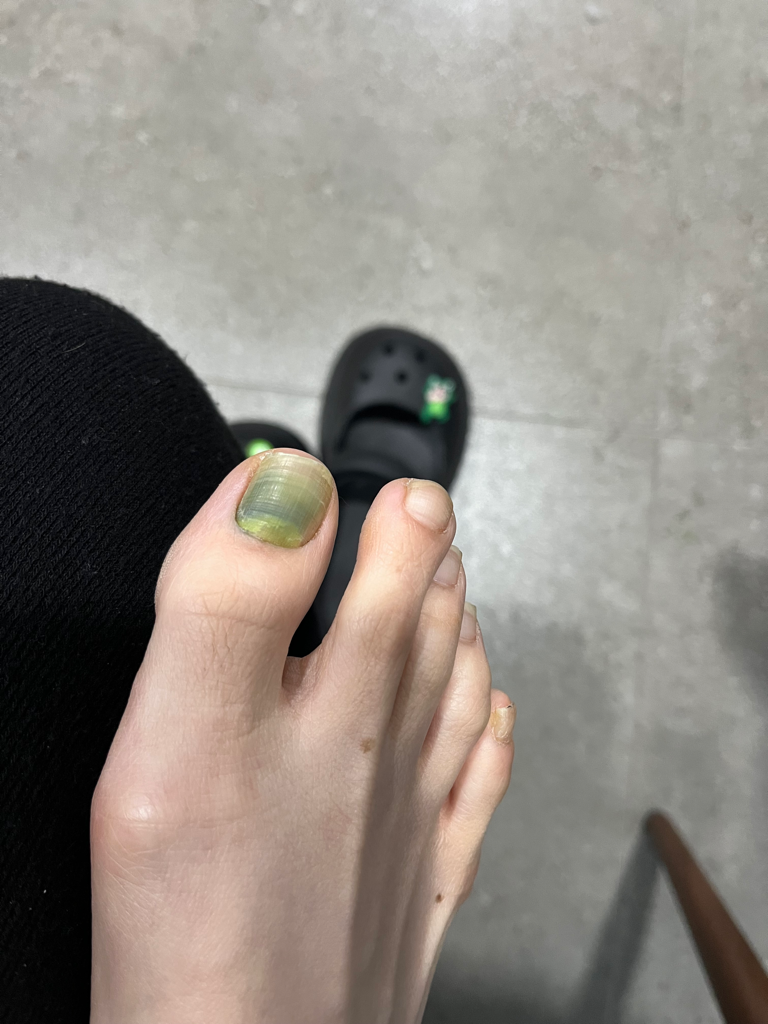 3번 째 사진
