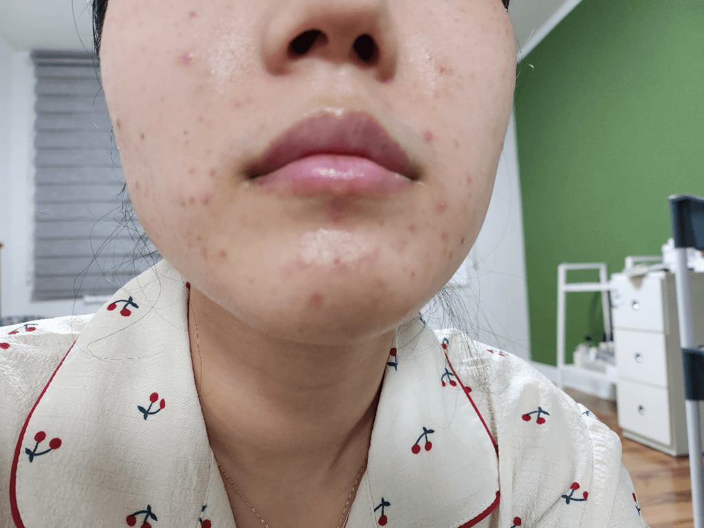 1번 째 사진