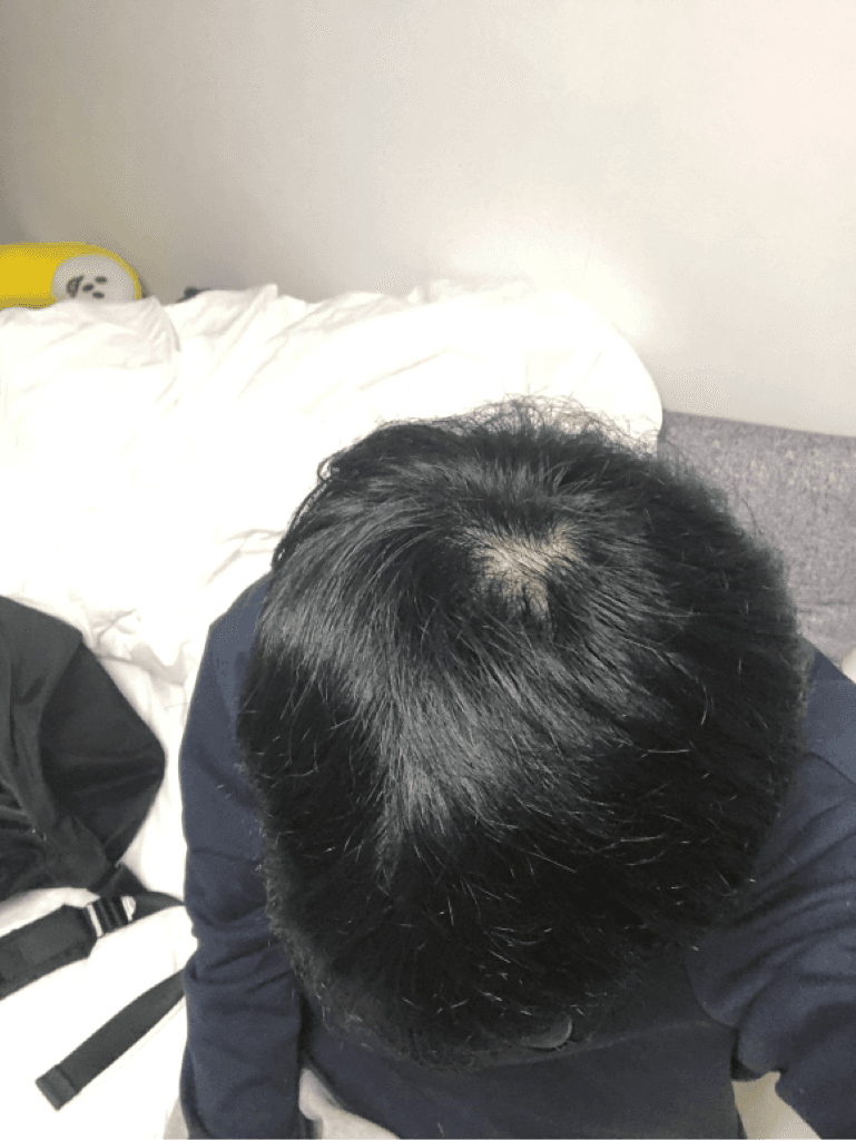 2번 째 사진