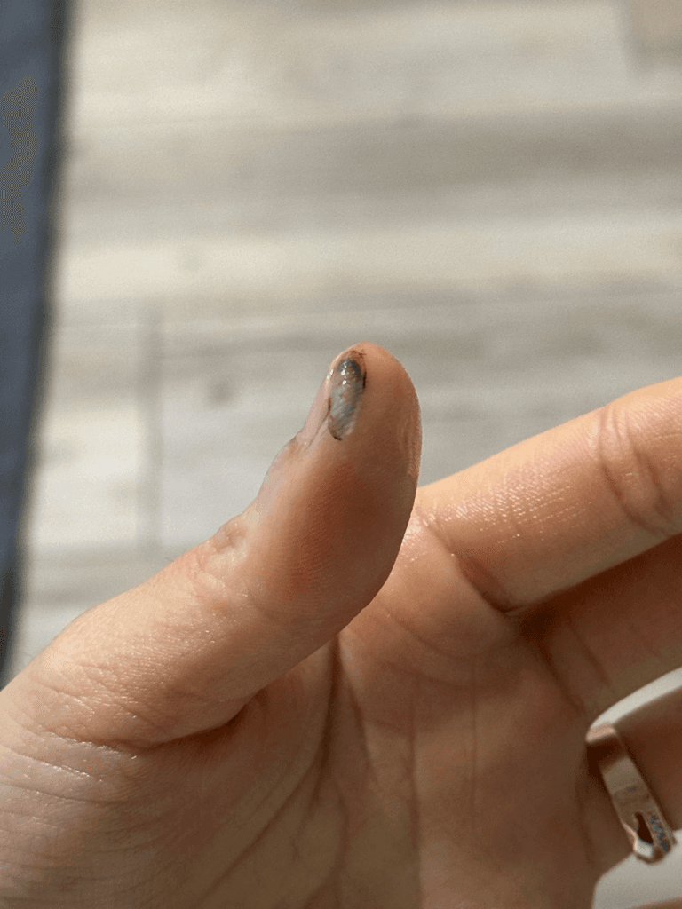 2번 째 사진