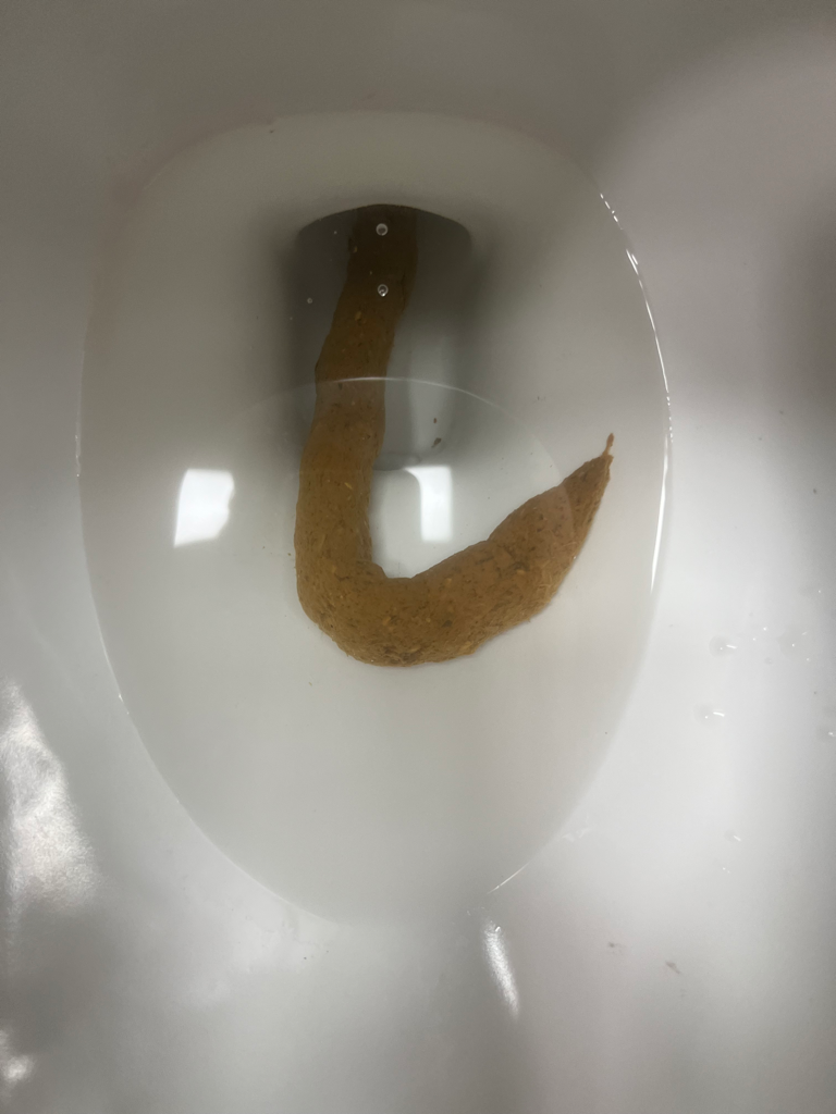 2번 째 사진