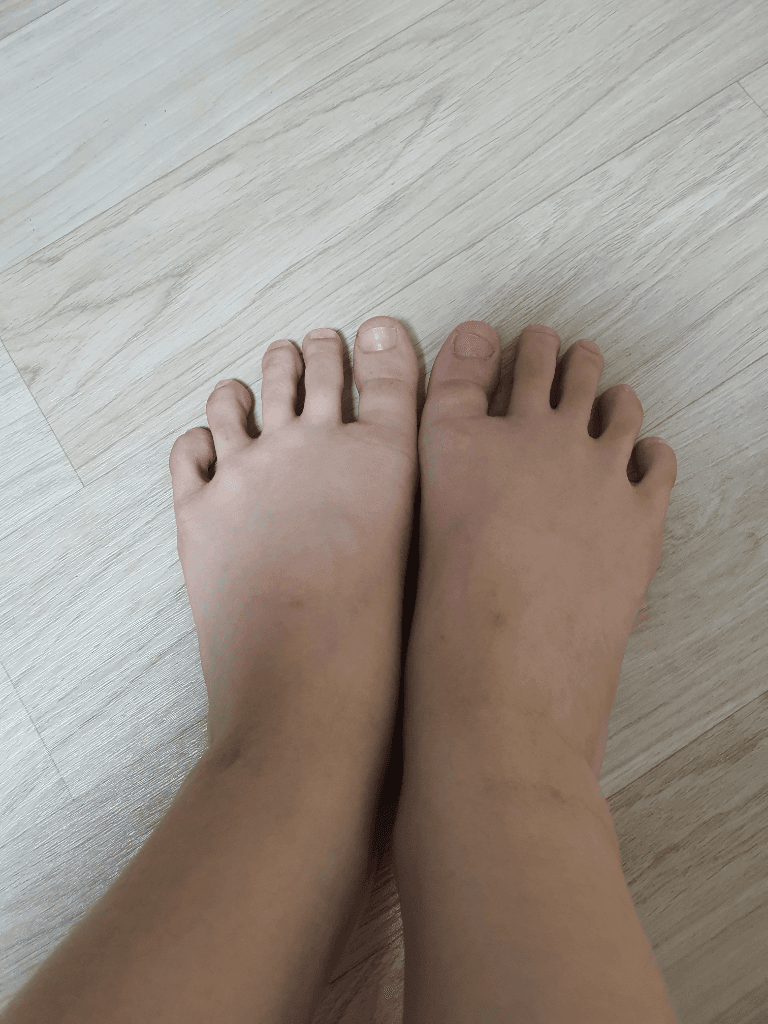 2번 째 사진