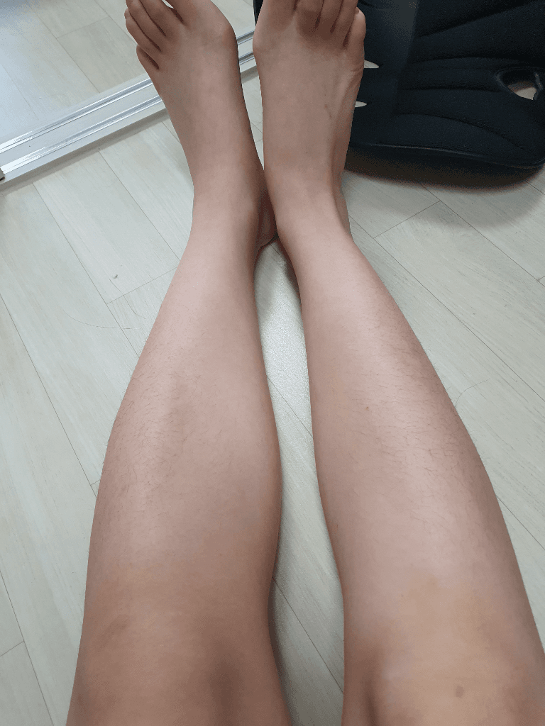 2번 째 사진