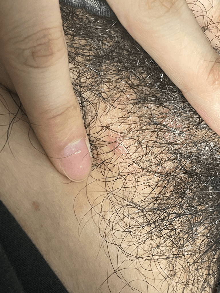 2번 째 사진