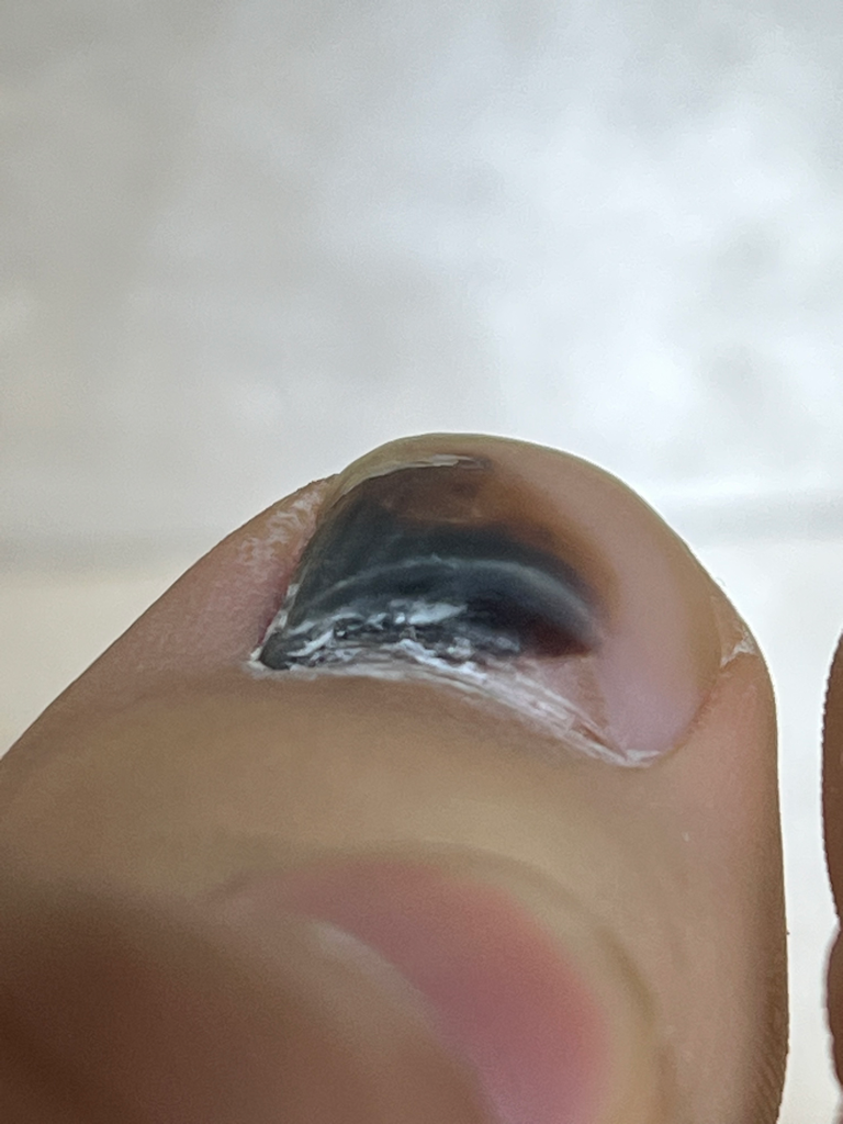2번 째 사진