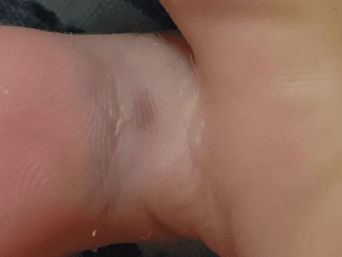 2번 째 사진
