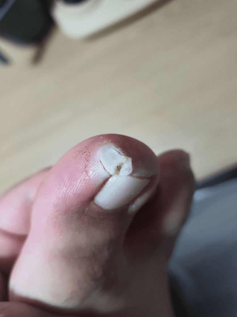 2번 째 사진