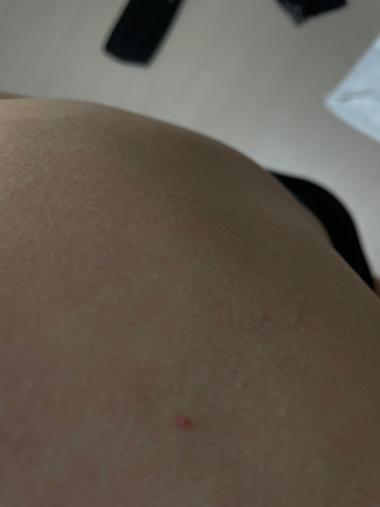 2번 째 사진