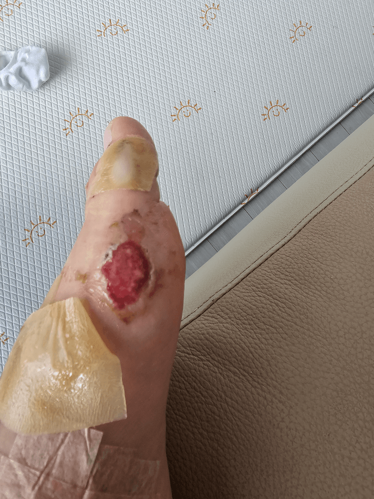1번 째 사진
