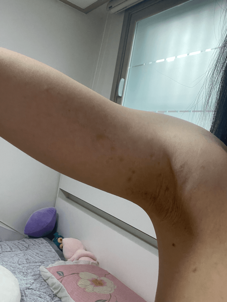 2번 째 사진