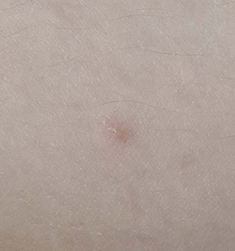 2번 째 사진