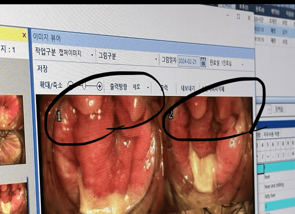 1번 째 사진