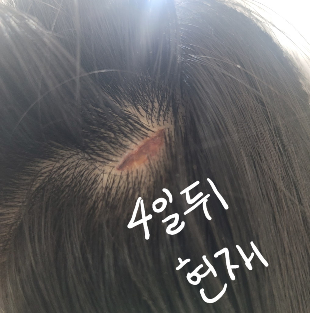 4번 째 사진