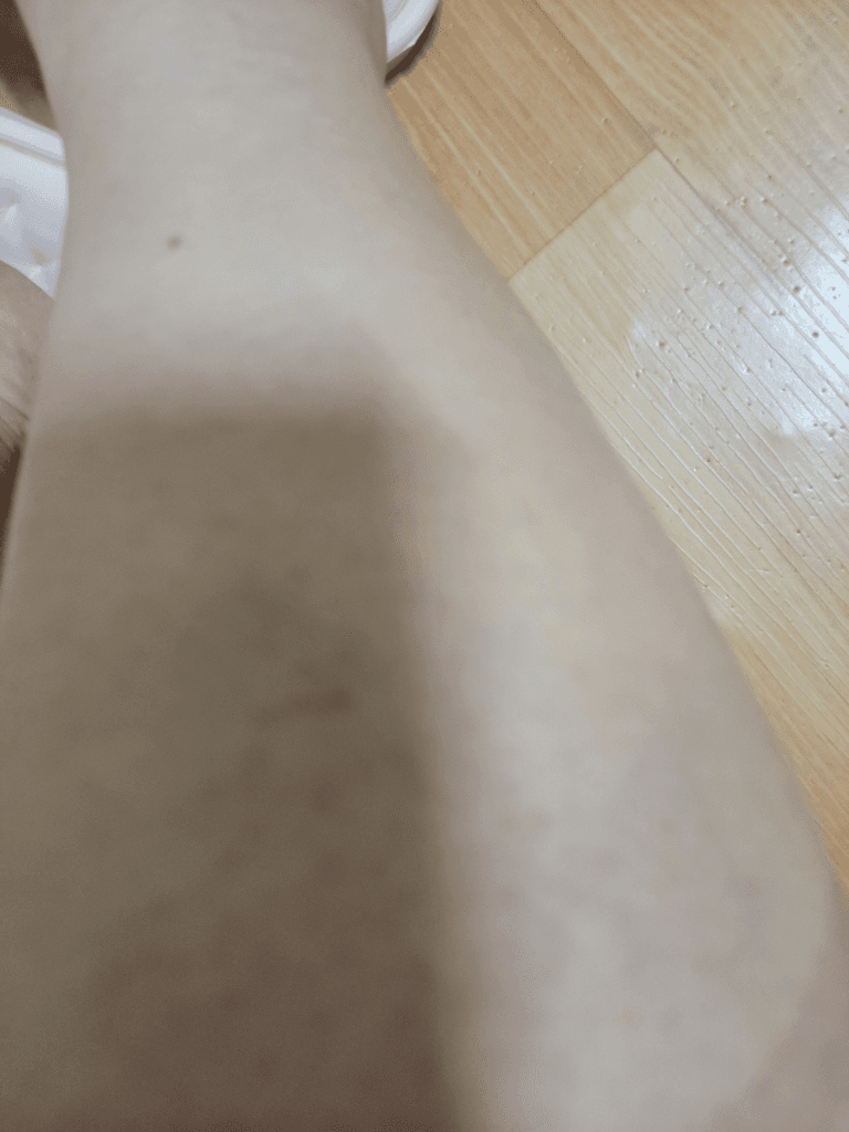 3번 째 사진