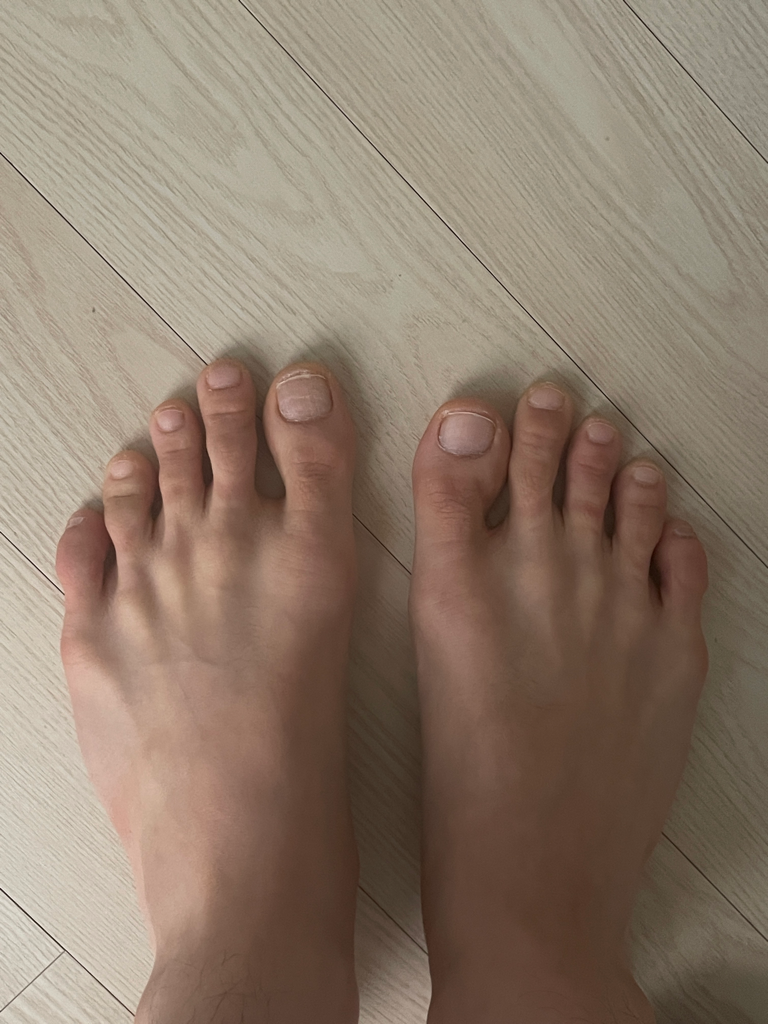 2번 째 사진