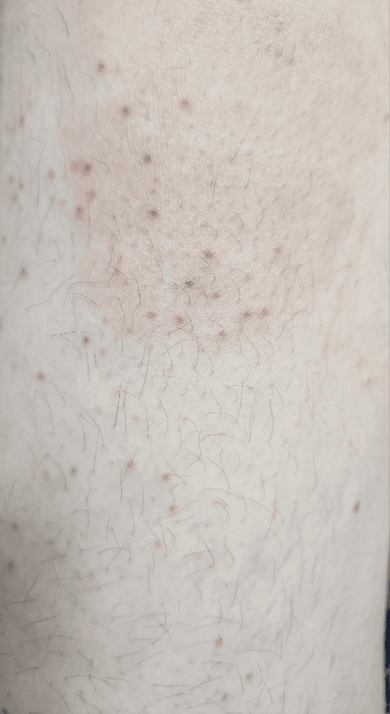 3번 째 사진
