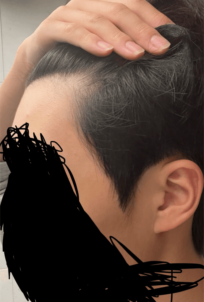 2번 째 사진