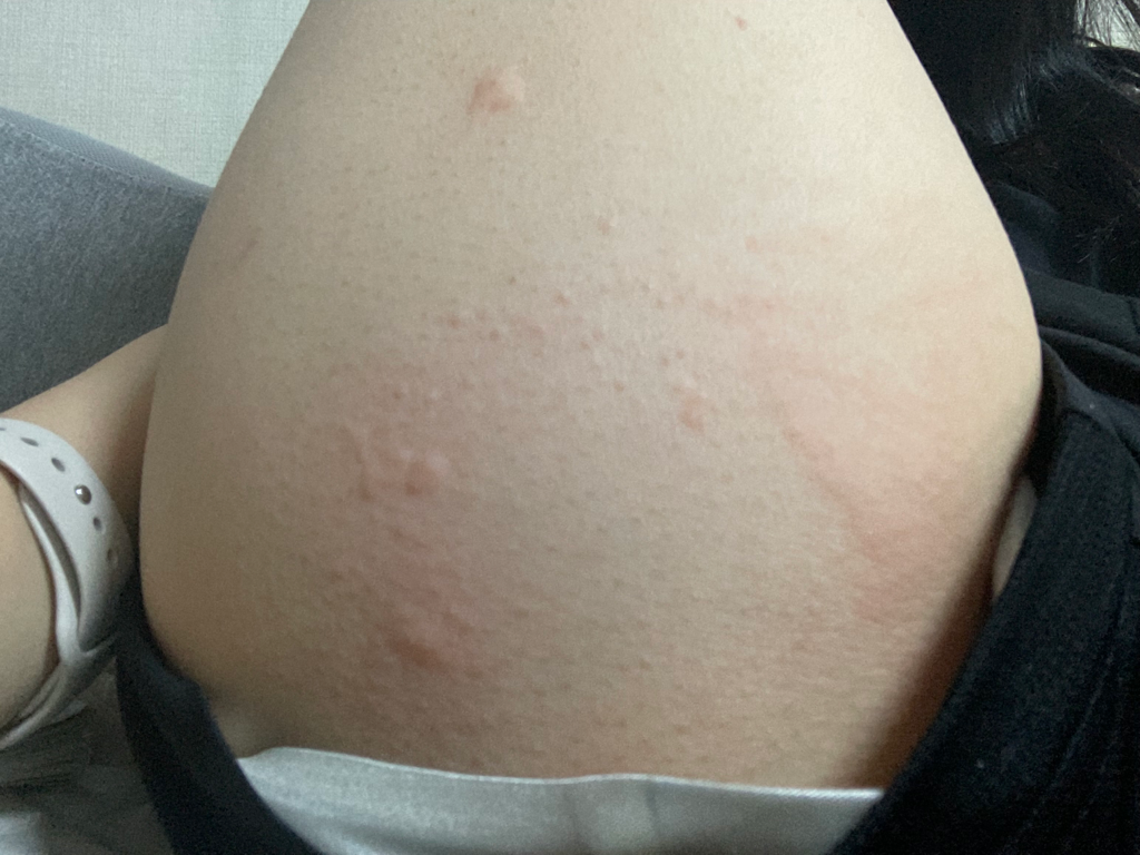 2번 째 사진