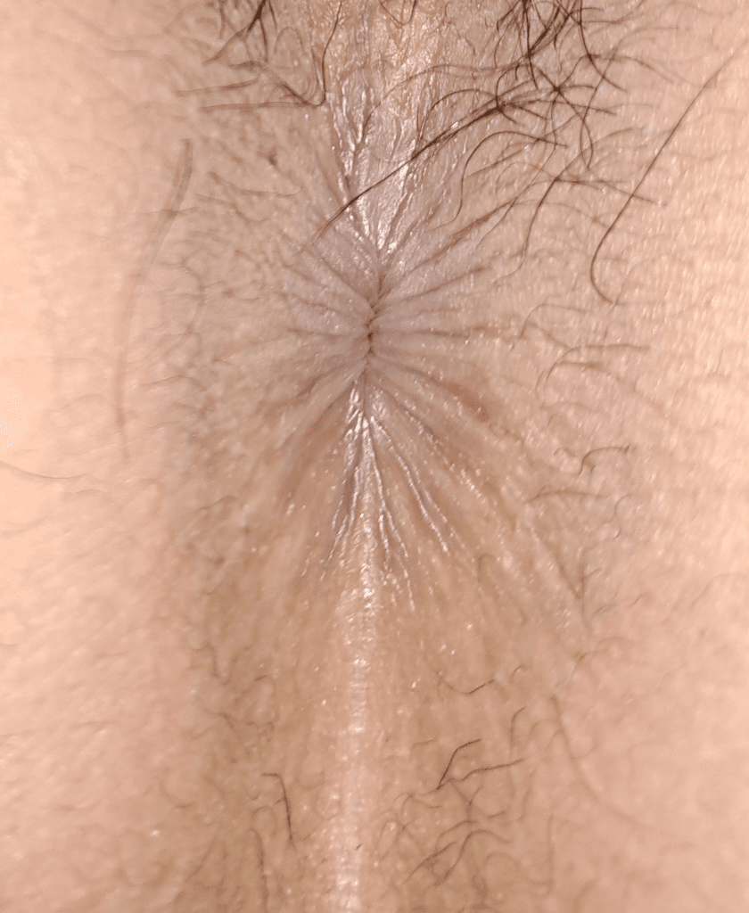2번 째 사진