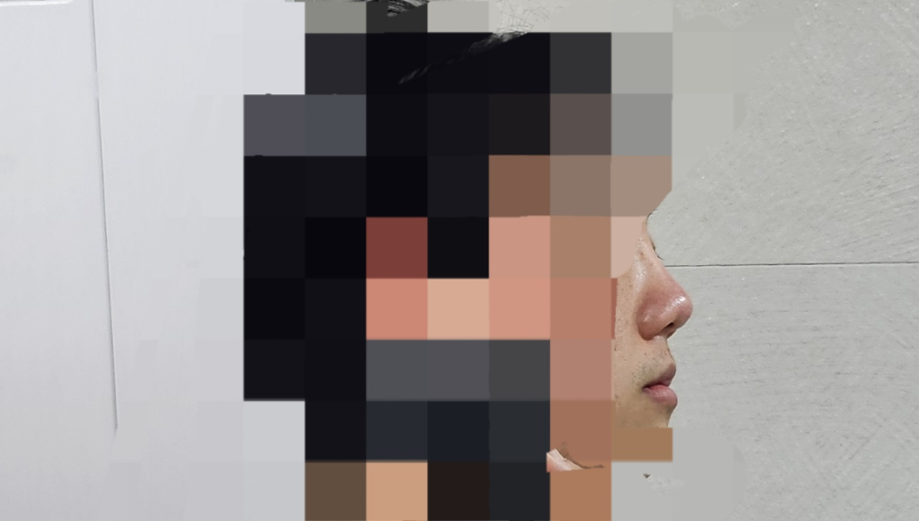 2번 째 사진