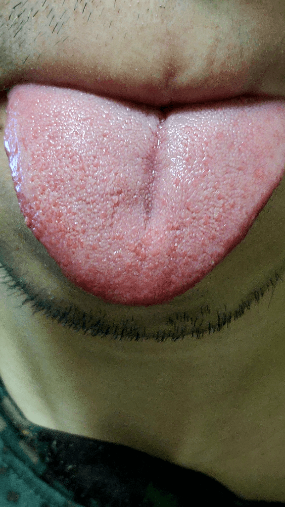 1번 째 사진