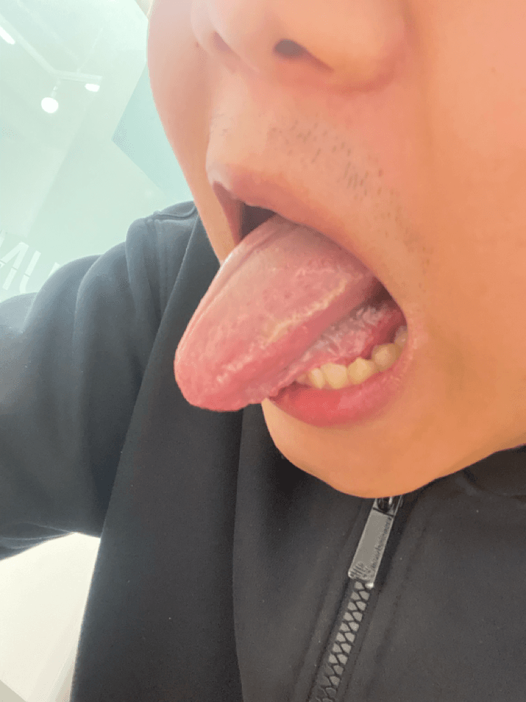 2번 째 사진