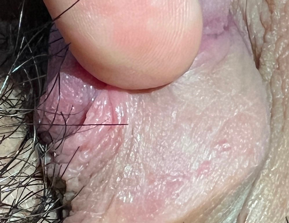 2번 째 사진
