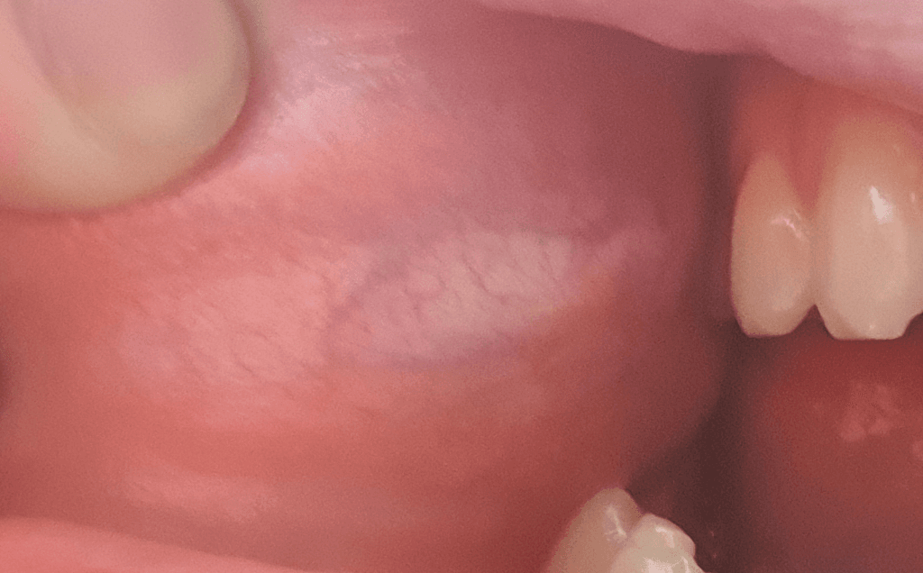 2번 째 사진