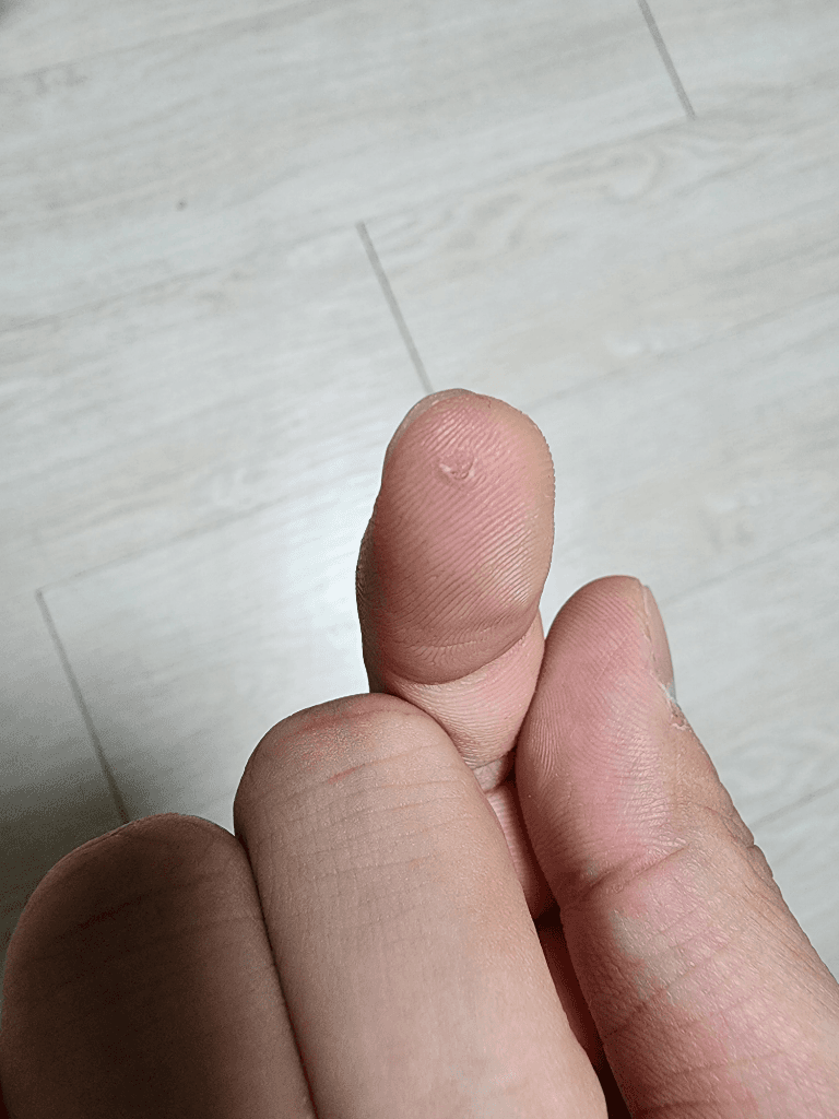 2번 째 사진