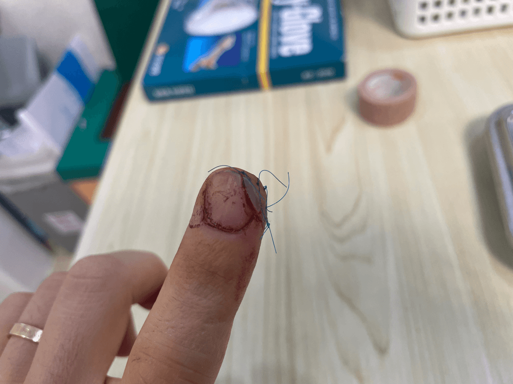 1번 째 사진