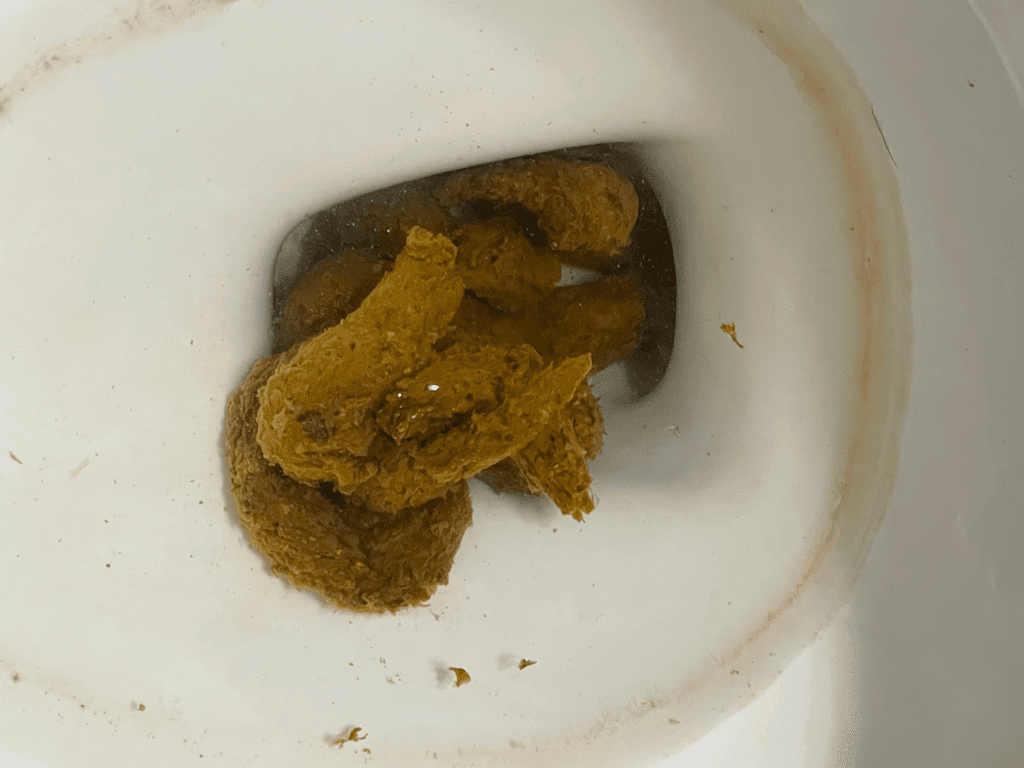 2번 째 사진