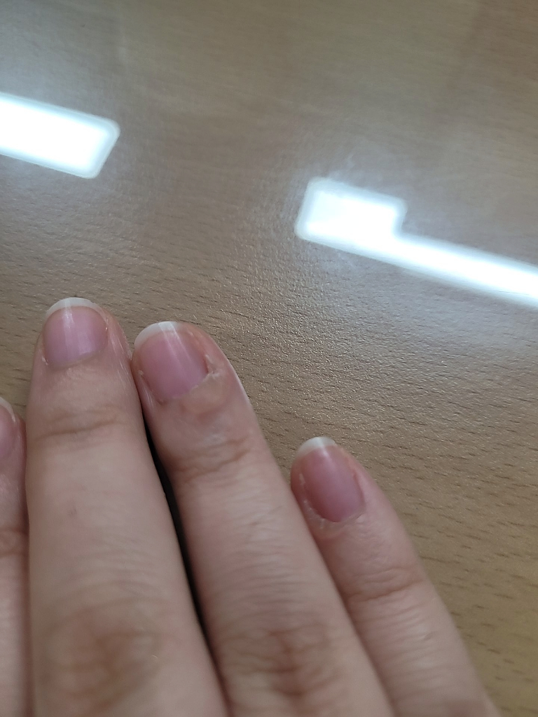 2번 째 사진