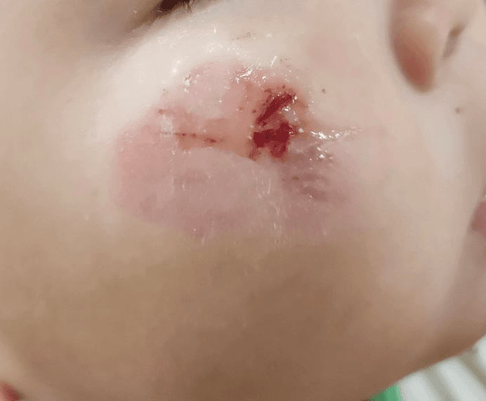 1번 째 사진