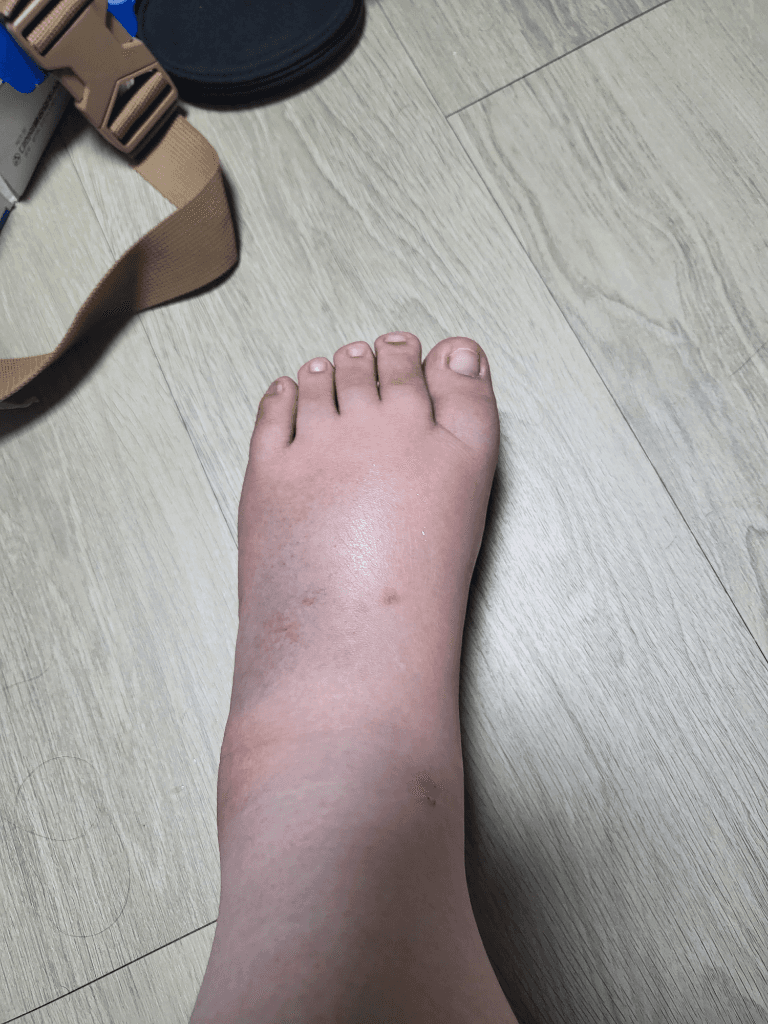 1번 째 사진