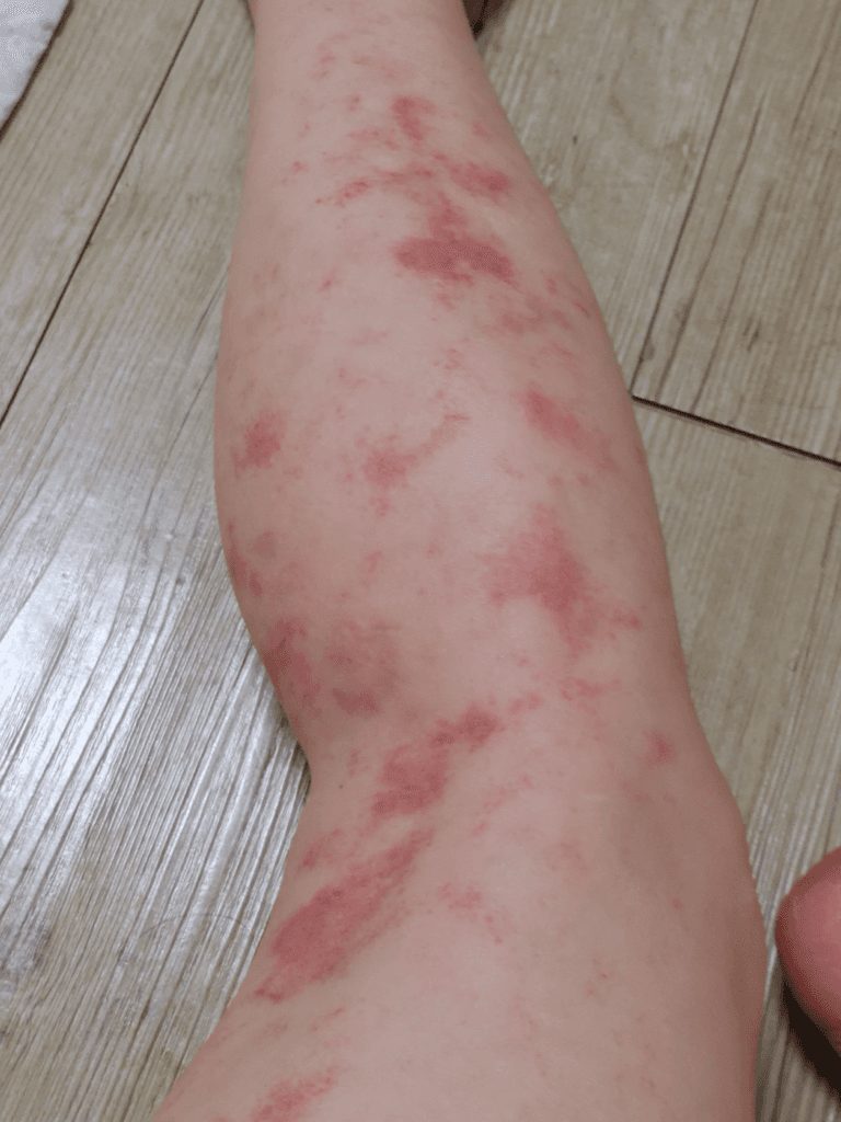 2번 째 사진